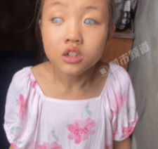 女孩2岁时基因突变双目失明 妈妈:产检时一切正常