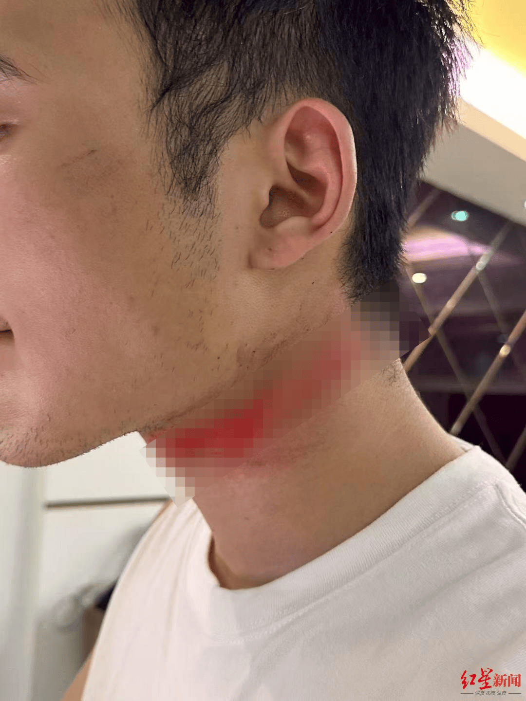 男主播骑车载女友回家被路边掉落网线勒伤脖子,索赔3万陷僵局 律师解读该谁赔