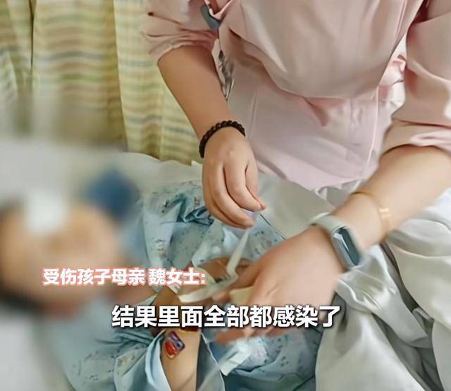 江西一5岁男孩在幼儿园被戳伤致左眼失明,家长称老师用猪油涂抹试图消肿